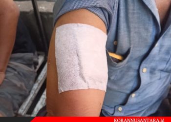 Beruk Masih Mengkhawatirkan Masyarakat Tanjungbalai 