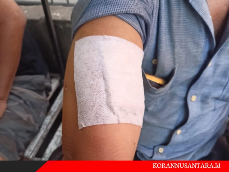 Beruk Masih Mengkhawatirkan Masyarakat Tanjungbalai 