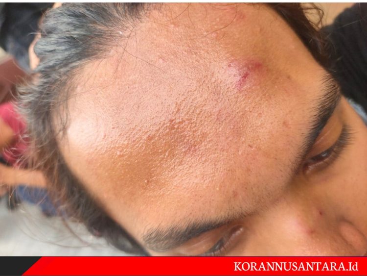 Ricuh, Aktivis GMKI Jakarta Sesalkan Tindakan Represif Kepolisian Metro Jakarta Utara, GMKI : Kami Mau Menuntut Keadilan