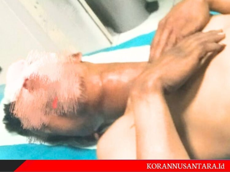 Tiga orang tukang parkir Alaska Jadi Korban Pengeroyokan OTK