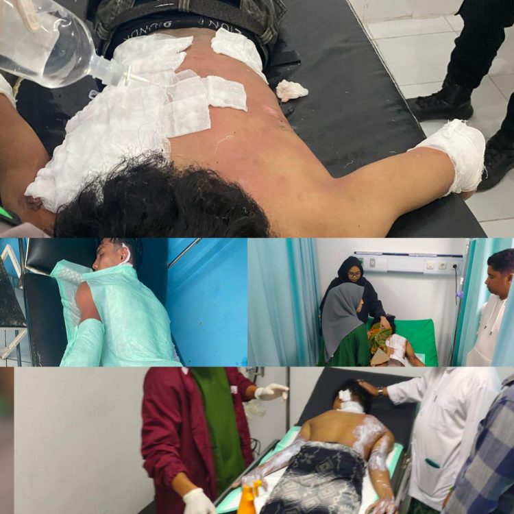 PRESISI TELAH BASI “Mahasiswa Terbakar, Demokrasi Menghangus”