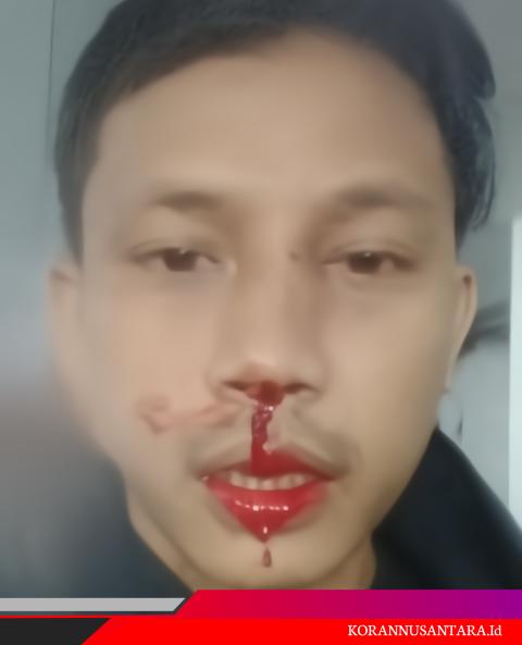 Aksi Mahasiswa di Kejatisu :Dugaan Kasus Korupsi Dana COVID-19, Massa Aksi Diserang Brutal Oknum Preman, Mahasiswa Akan Lapor Ke DPP Golkar dan Presiden