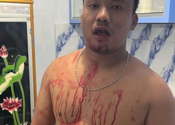 Ketua LPM Sunggal Dipukuli OTK di Kantor Desa Fuji Mulio