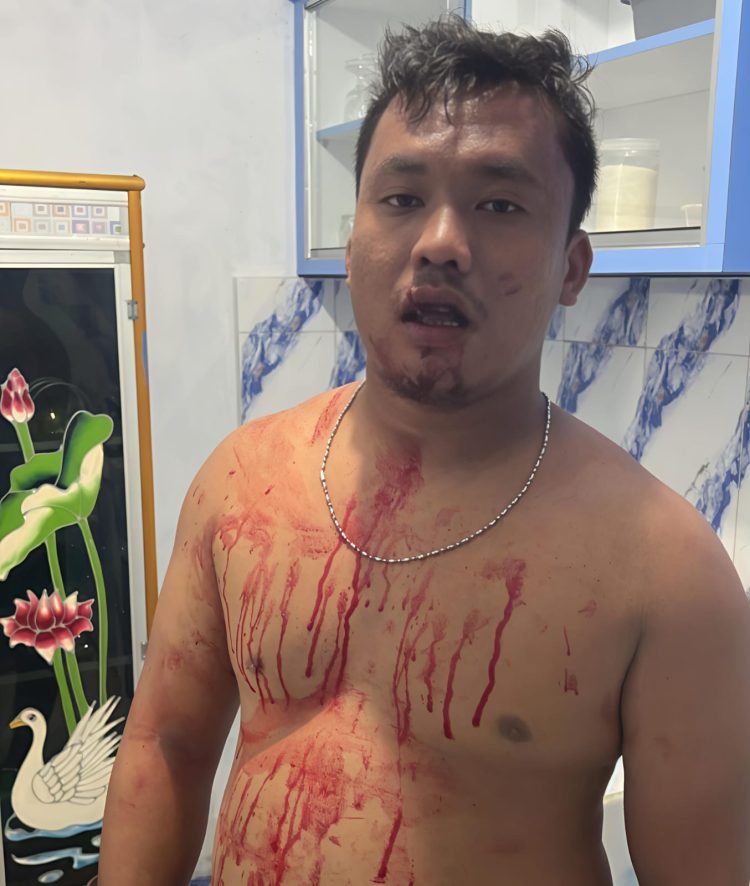 Ketua LPM Sunggal Dipukuli OTK di Kantor Desa Fuji Mulio