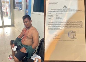 Ketua LPM Sunggal Dipukuli OTK di Kantor Desa Puji Mulyo , Resmi Lapor Polisi