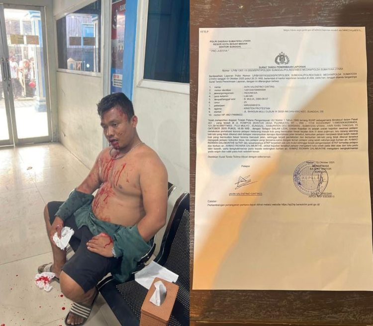 Ketua LPM Sunggal Dipukuli OTK di Kantor Desa Puji Mulyo , Resmi Lapor Polisi