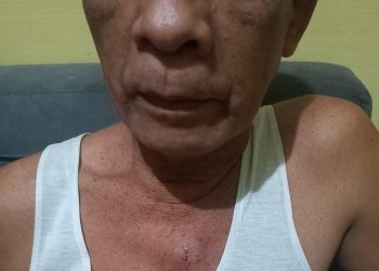 Korban Pengeroyokan Jadi Tersangka, Syahruddin Sudah 24 Hari Ditahan di Polsek Tamalate