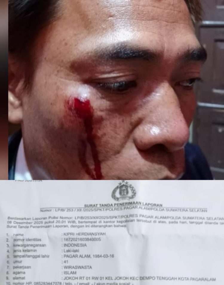 Wartawan Iwo Jadi Korban Penganiayaan, DPW IWO-I Sumsel Akan Kawal Hingga Tuntas