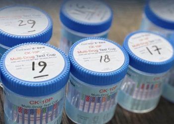 Anggaran Pengadaan 400 Ribu Alat Tes Urine Ditjen Pemasyarakatan Senilai Rp121,6 Miliar Disorot, Muncul Dugaan Markup Harga
