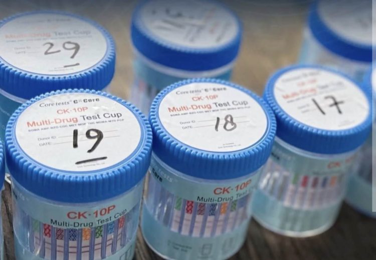 Anggaran Pengadaan 400 Ribu Alat Tes Urine Ditjen Pemasyarakatan Senilai Rp121,6 Miliar Disorot, Muncul Dugaan Markup Harga