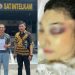 Keluarga Winda Lorenza Samosir Layangkan Surat Pemberitahuan Aksi Desak Eksumasi dan Autopsi Ulang